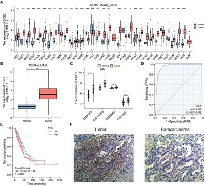 ECE2 is a prognostic biomarker associated with m6A modification and involved in immune infiltration of lung adenocarcinoma